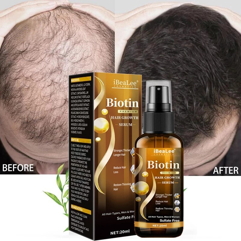 Roots Nutrition & Fitness Inglewood Photos - Hair care solution, strong hair nutrition,
