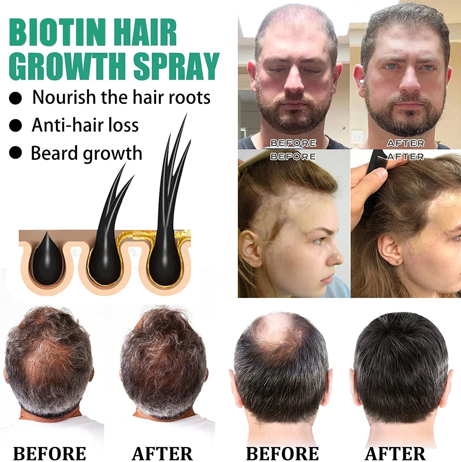 Hair care solution, strong hai - Roots Nutrition & Fitness Inglewood Photos ulasan dan harga