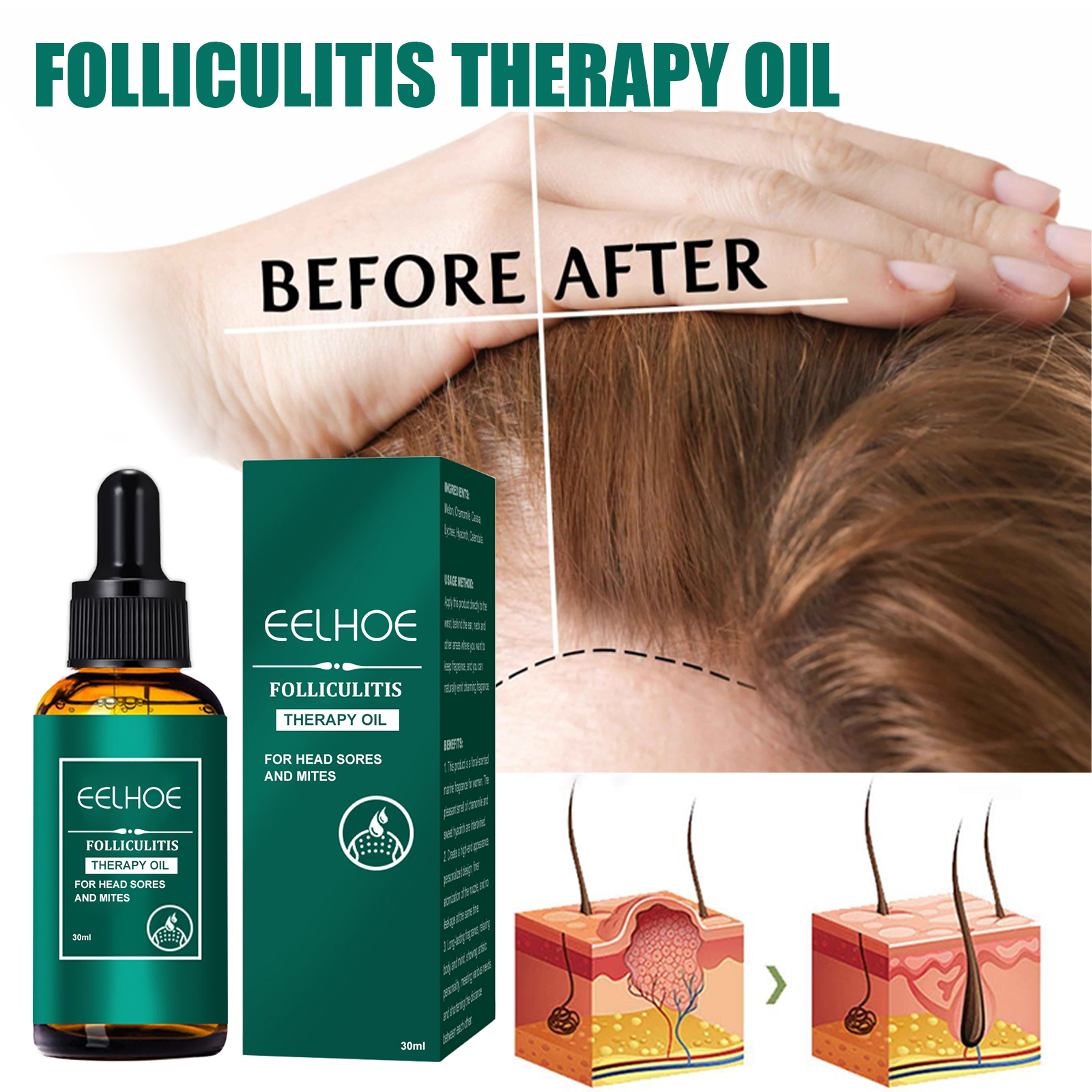 Scalp Treatment Serum Follicle - Roots Nutrition & Fitness Inglewood Photos ulasan dan harga