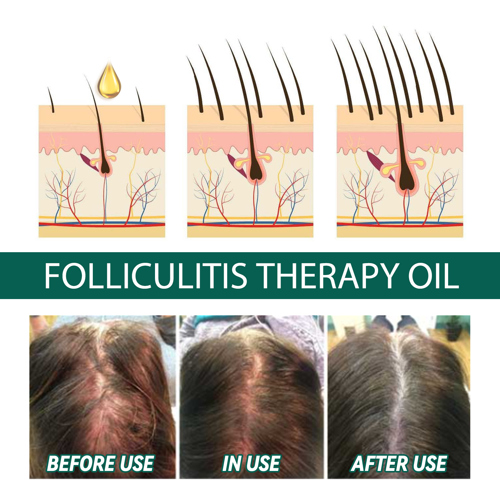 Scalp Treatment Serum Follicle - Roots Nutrition & Fitness Inglewood Photos ulasan dan harga